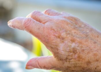 Eczema Changes with Age-Research

Photo Courtesy