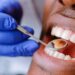 Managing Toothaches: Causes, Treatment and Prevention