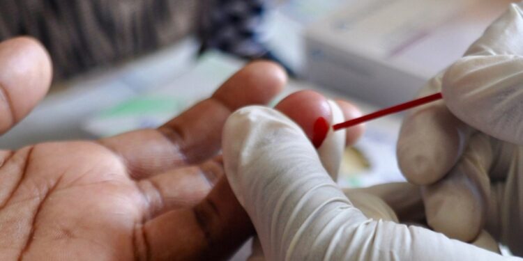 HIV test in progress. Photo/Courtesy