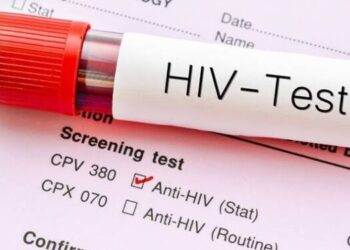 Govt Assures Kenyans on Quality of HIV Testing Kits