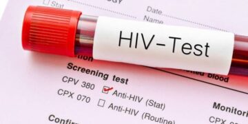 Govt Assures Kenyans on Quality of HIV Testing Kits